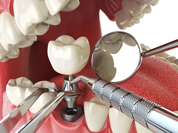 Emergency Dentist Open Today in KY